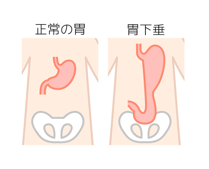 筋力の低下